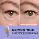 InfiniteLift - Gel Rejuvenescedor da Área dos Olhos